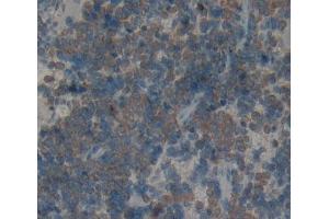Used in DAB staining on fromalin fixed paraffin- embedded Kidney tissue (KLRK1 anticorps  (AA 75-215))