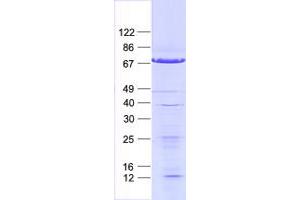 Validation with Western Blot