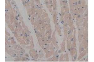 IHC-P analysis of Mouse Heart Tissue, with DAB staining. (MAP6 anticorps  (AA 177-387))