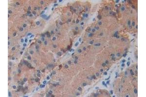 Detection of GHRH in Human Stomach Tissue using Monoclonal Antibody to Growth Hormone Releasing Hormone (GHRH)