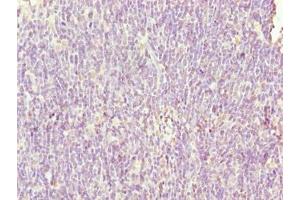 Immunohistochemistry of paraffin-embedded human thymus tissue using ABIN7169483 at dilution of 1:100 (SH3BGRL3 anticorps  (AA 2-93))