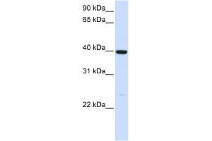 ADH1A antibody used at 1 ug/ml to detect target protein. (ADH1A anticorps)