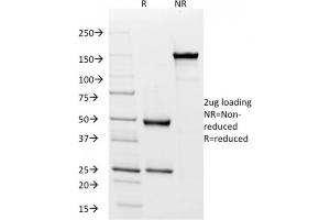 SDS-PAGE Analysis Purified HLA-Pan Mouse Recombinant Monoclonal Antibody (rHLA-Pan/3475).