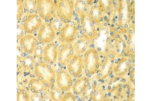 Immunohistochemistry of paraffin-embedded Mouse kidney using PDE4DIP Polyclonal Antibody at dilution of 1:100 (40x lens). (PDE4DIP anticorps)