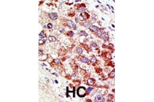 Immunohistochemistry (IHC) image for anti-Cbl proto-oncogene C (CBLC) antibody (ABIN2996831) (CBLC anticorps)
