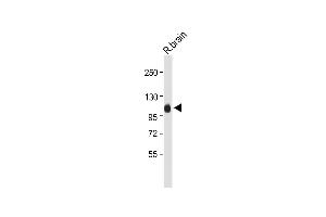 Anti-G Antibody (Center) at 1:2000 dilution + Rat brain whole tissue lysate Lysates/proteins at 20 μg per lane.