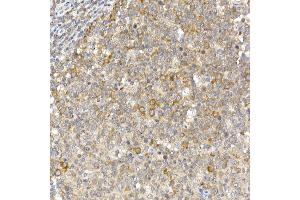 Immunohistochemistry of paraffin-embedded human tonsil using Caspase-12 Rabbit pAb (ABIN6134631, ABIN6137956, ABIN6137957 and ABIN6213679) at dilution of 1:100 (40x lens).