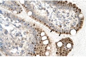 Rabbit Anti-ZFP1 Antibody Catalog Number: ARP31586 Paraffin Embedded Tissue: Human Intestine Cellular Data: Epithelial cells of intestinal villas Antibody Concentration: 4. (Zfp-1 anticorps  (N-Term))