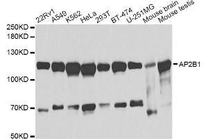 Western blot analysis of extracts of various cell lines, using AP2B1 antibody (ABIN1871002) at 1:1000 dilution.