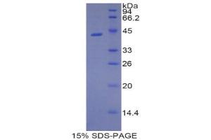 SDS-PAGE (SDS) image for Lipocalin 9 (LCN9) (AA 33-163) protein (His tag,GST tag) (ABIN2123188) (LCN9 Protein (AA 33-163) (His tag,GST tag))