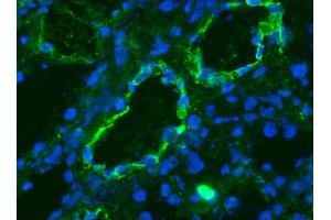 Image no. 2 for anti-K-Cadherin (CDH6) antibody (ABIN335402)