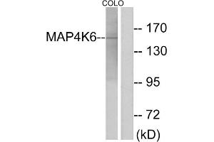 Western blot analysis of extracts from COLO cells, using MAP4K6 antibody. (MAP4K6 anticorps  (Internal Region))