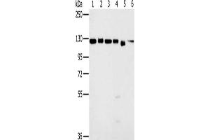 Gel: 6 % SDS-PAGE, Lysate: 40 μg, Lane 1-6: 293T cells, K562 cells, hela cells, 231 cells, Jurkat cells, NIH/3T3 cells, Primary antibody: ABIN7130189(MATR3 Antibody) at dilution 1/500, Secondary antibody: Goat anti rabbit IgG at 1/8000 dilution, Exposure time: 3 seconds (MATR3 anticorps)