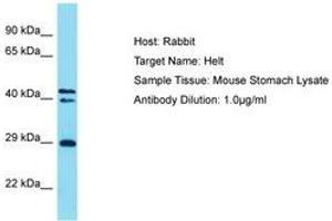 Image no. 1 for anti-Helt BHLH Transcription Factor (HELT) (AA 138-187) antibody (ABIN6750287)
