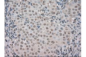 Image no. 3 for anti-Budding Uninhibited By Benzimidazoles 1 Homolog beta (Yeast) (BUB1B) antibody (ABIN1497000) (BUB1B anticorps)