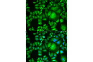 Immunofluorescence analysis of HeLa cells using CBR1 antibody (ABIN5973163). (CBR1 anticorps)
