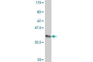 Western Blot detection against Immunogen (36. (GIPC1 anticorps  (AA 61-158))