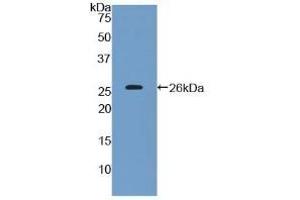 Detection of Recombinant CD200, Human using Polyclonal Antibody to Cluster Of Differentiation 200 (CD200) (CD200 anticorps  (AA 31-232))