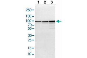 Western blot analysis of Lane 1: NIH-3T3 cell lysate, Lane 2: NBT-II cell lysate, Lane 3: PC12 cell lysate with ACO2 polyclonal antibody . (ACO2 anticorps  (AA 544-693))