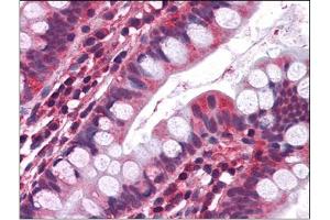 Immunohistochemistry Image: Human Small Intestine: Formalin-Fixed, Paraffin-Embedded (FFPE) (Serotonin Receptor 3A anticorps  (Internal Region))