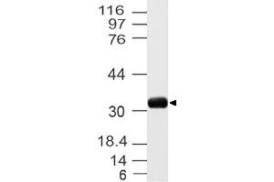 Image no. 1 for anti-Uncoupling Protein 3 (Mitochondrial, Proton Carrier) (UCP3) (AA 1-300) antibody (ABIN5027619) (UCP3 anticorps  (AA 1-300))