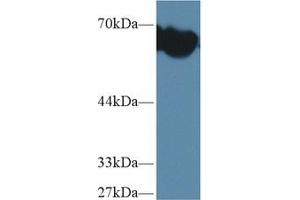 Detection of AFP in Mouse Blood Cells lysate using Polyclonal Antibody to Alpha-Fetoprotein (AFP)