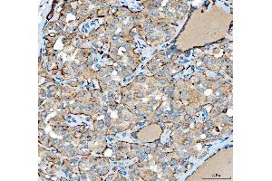 IHC analysis of SIAE using anti-SIAE antibody (ABIN7600774). (SIAE anticorps  (AA 230-523))