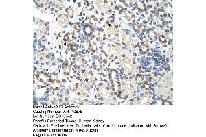 Rabbit Anti-NXF3 Antibody  Paraffin Embedded Tissue: Human Kidney Cellular Data: Epithelial cells of renal tubule Antibody Concentration: 4. (NXF3 anticorps  (C-Term))