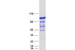 Validation with Western Blot