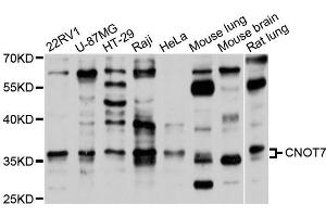 Western blot analysis of extracts of various cell lines, using CNOT7 antibody (ABIN5995835) at 1/1000 dilution. (CNOT7 anticorps)