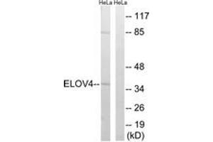 Western Blotting (WB) image for anti-ELOVL Fatty Acid Elongase 4 (ELOVL4) (AA 41-90) antibody (ABIN2890303) (ELOVL4 anticorps  (AA 41-90))