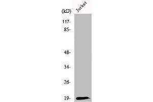 Western Blot analysis of K562 cells using RCL Polyclonal Antibody (RCL anticorps  (N-Term))
