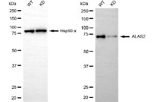Western blotting analysis using ALAS2 antibody (ABIN7797591). (Recombinant ALAS2 anticorps)