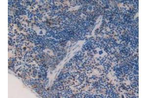 Detection of C1qA in Mouse Spleen Tissue using Polyclonal Antibody to Complement Component 1, Q Subcomponent A (C1qA) (C1QA anticorps  (AA 23-245))