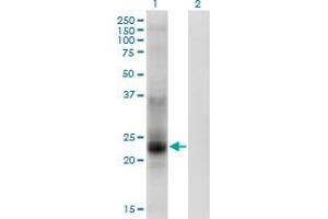 Western Blot analysis of TSPAN8 expression in transfected 293T cell line by TSPAN8 monoclonal antibody (M02), clone 1E5. (Tspan-8 anticorps  (AA 110-205))