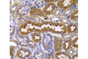 Immunohistochemistry of paraffin-embedded Mouse kidney using PRKAB1 Polyclonal Antibody at dilution of 1:100 (40x lens).