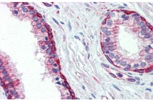 Immunohistochemistry with Human Prostate lysate tissue at an antibody concentration of 5. (UBE2L3 anticorps  (C-Term))