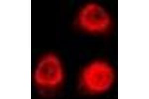Immunofluorescent analysis of Uev1A staining in U2OS cells. (UBE2V1 anticorps)