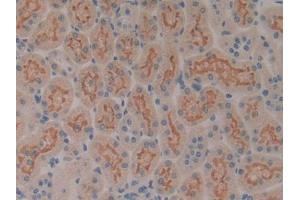 IHC-P analysis of Rat Kidney Tissue, with DAB staining. (SP100 anticorps  (AA 116-333))
