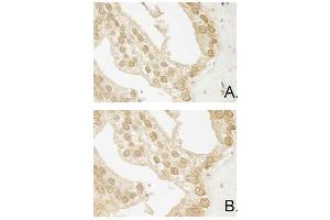 Immunohistochemistry of Mouse Anti-AKT3 antibody.