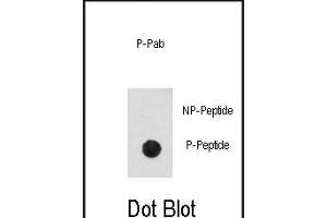 Dot blot analysis of anti-Phospho-CDK2-pT14 Antibody (ABIN389996 and ABIN2839773) on nitrocellulose membrane. (CDK2 anticorps  (pThr14))