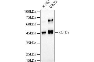 Western blot analysis of extracts of various cell lines, using KCTD9 antibody (ABIN7269469) at 1:500 dilution. (KCTD9 anticorps)