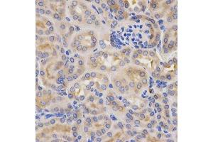 Immunohistochemistry of paraffin-embedded mouse kidney using CFB antibody. (Complement Factor B anticorps  (AA 80-420))