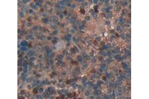 IHC-P analysis of Rat Tissue, with DAB staining. (NFkB anticorps  (AA 352-439))