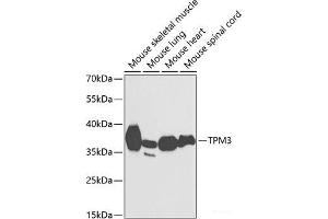 Western blot analysis of extracts of various cell lines using TPM3 Polyclonal Antibody at dilution of 1:1000. (TPM3 anticorps)