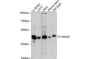 Western blot analysis of extracts of various cell lines, using PARVB antibody (ABIN6127617, ABIN6145244, ABIN6145245 and ABIN6217054) at 1:3000 dilution. (Parvin, beta anticorps  (AA 1-100))