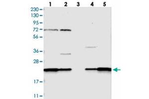Western blot analysis of Lane 1: RT-4, Lane 2: U-251 MG, Lane 3: Human Plasma, Lane 4: Liver, Lane 5: Tonsil with SPCS2 polyclonal antibody  at 1:250-1:500 dilution. (SPCS2 anticorps)