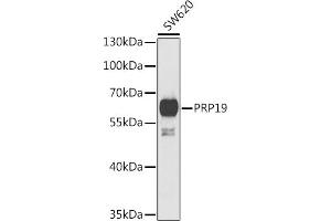 Western blot analysis of extracts of SW620 cells, using PRP19 antibody (ABIN6132439, ABIN6146257, ABIN6146259 and ABIN6222419) at 1:1000 dilution. (PRP19 anticorps  (AA 1-220))