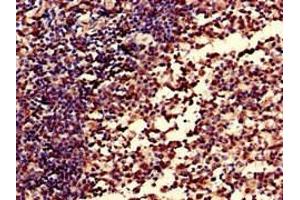 Immunohistochemistry of paraffin-embedded human tonsil tissue using ABIN7148409 at dilution of 1:100 (CD35 anticorps  (AA 901-1095))
