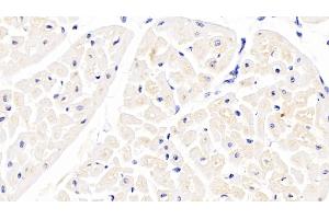 Detection of APOB100 in Bovine Cardiac Muscle Tissue using Polyclonal Antibody to Apolipoprotein B100 (APOB100) (Apo-B100 anticorps  (AA 4331-4567))